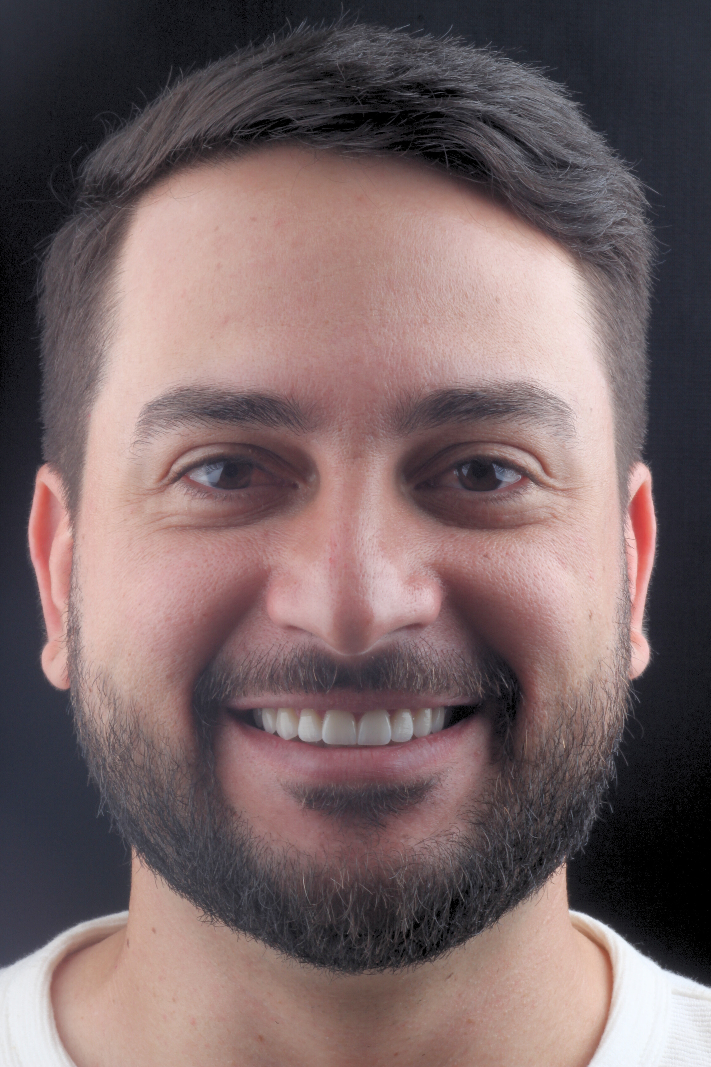 Estética Avançada (Lentes de Contato, Facetas e Coroas)